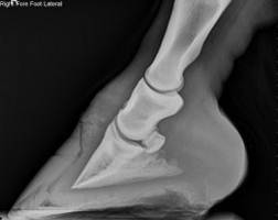 x-ray of a foot