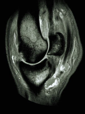 horse-MRI