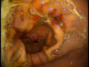 close-up of a baby inside a body