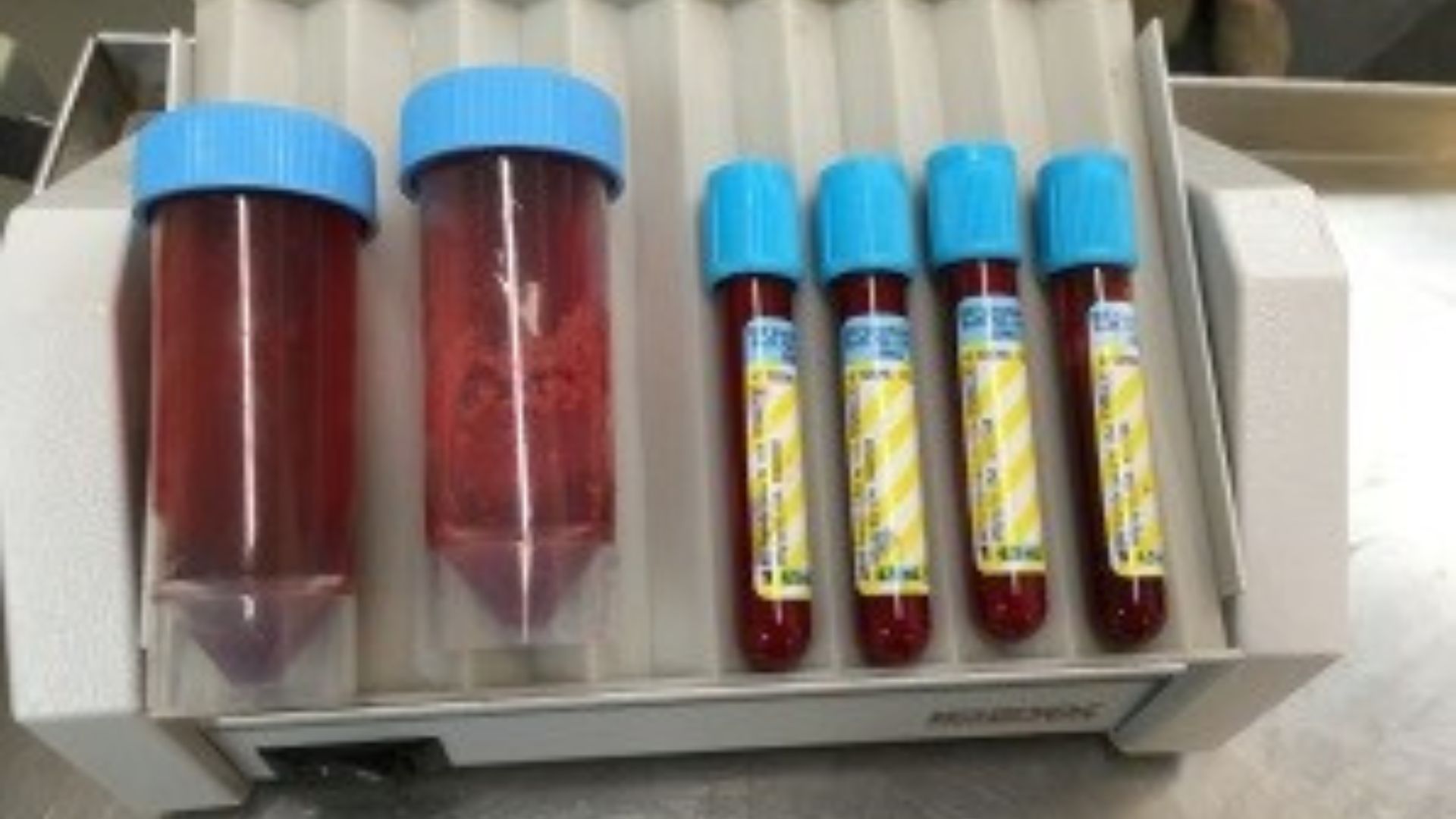 a group of test tubes in a plastic container