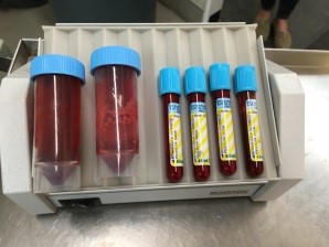 vials of blood for testing