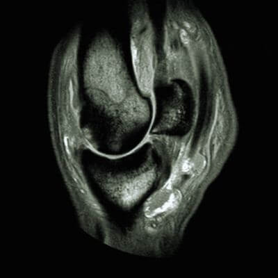 Magnetic resonance imaging image